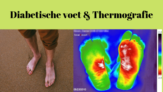 Diabetische Voeten en Thermografie