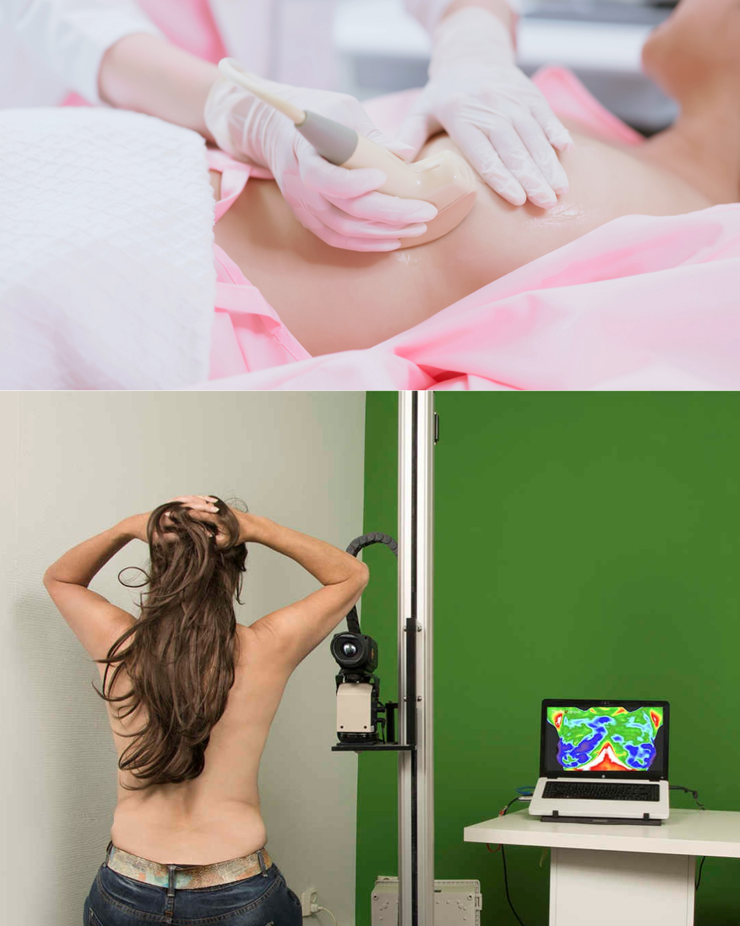Waarom thermografie en echografie bij elkaar horen